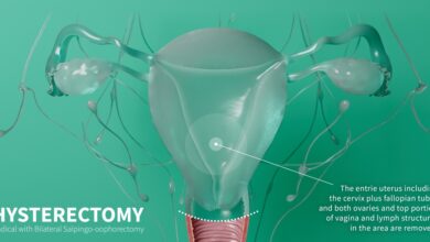 Rhian Butlin Unnecessary Hysterectomy