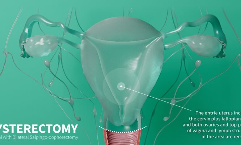 Rhian Butlin Unnecessary Hysterectomy
